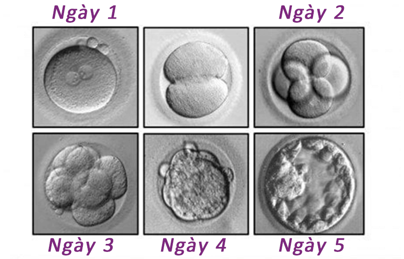 Nuôi cấy phôi ngày 5 Nuôi cấy phôi ngày 5