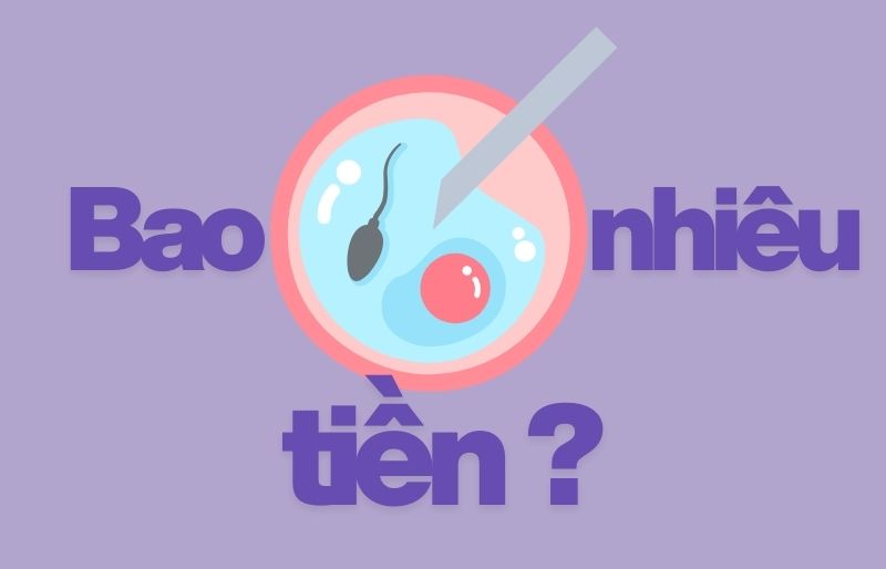 Làm IUI bao nhiêu tiền Làm IUI bao nhiêu tiền