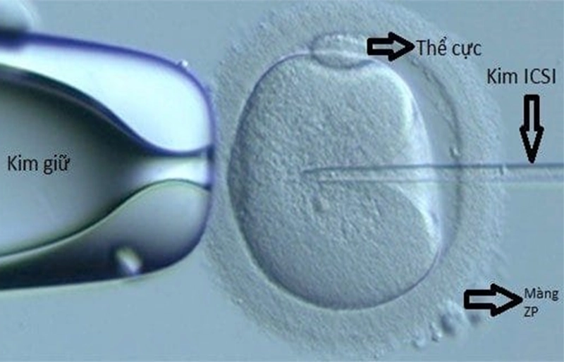 Kỹ thuật và công nghệ sử dụng