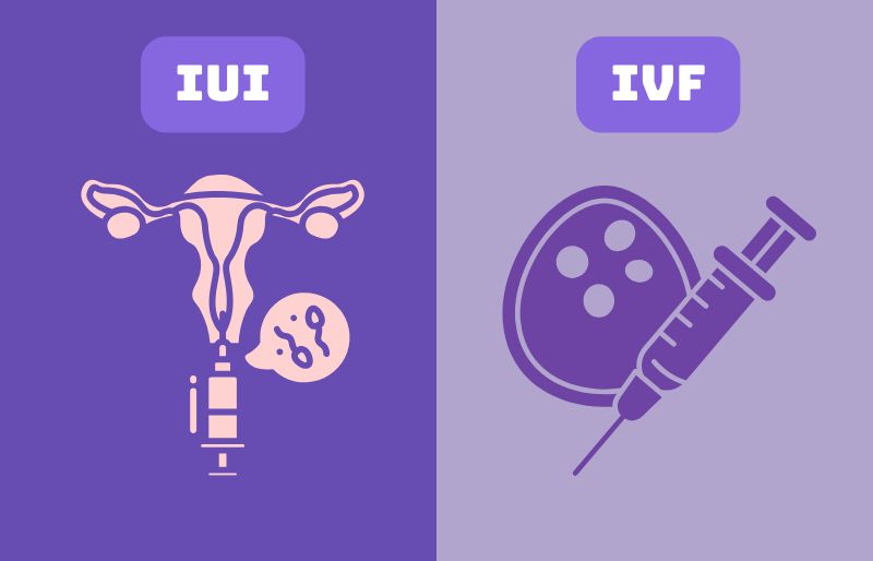 So sánh chi phí của IUI và IVF So sánh chi phí của IUI và IVF