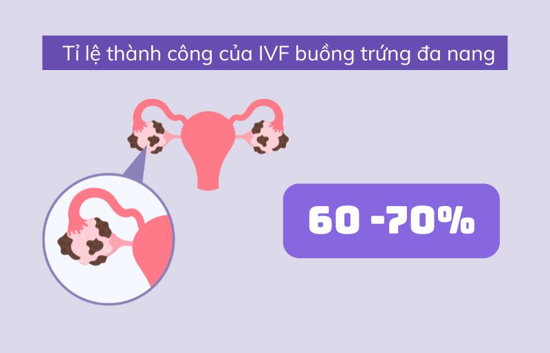 Tỉ lệ thành công của IVF buồng trứng đa nang