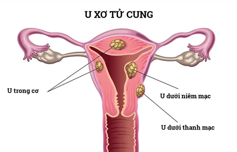 Đánh giá tình trạng buồng tử cung