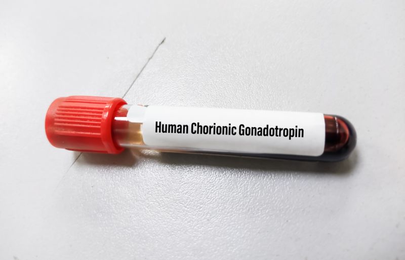 Nồng độ hCG
