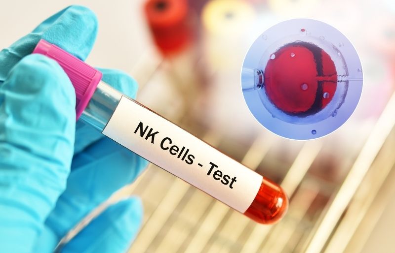 Xét nghiệm NK trong IVF là gì Xét nghiệm NK trong IVF là gì