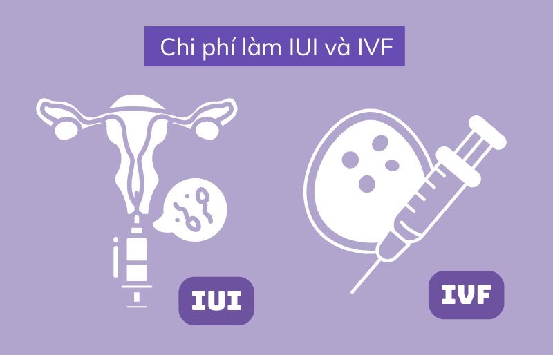 Chi phí làm IUI và IVF bao nhiêu tiền Chi phí làm IUI và IVF bao nhiêu tiền
