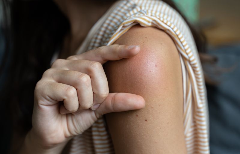 Đau hoặc sưng tại vị trí tiêm