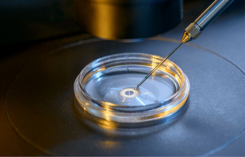Phương pháp ICSI tiêm tinh trùng vào bào tương trứng Phương pháp ICSI tiêm tinh trùng vào bào tương trứng