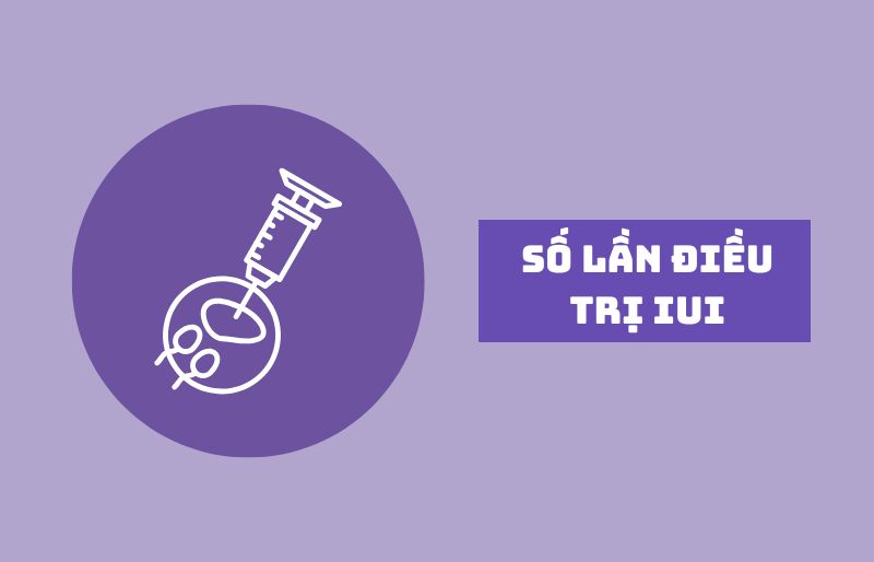 Số chu kỳ điều trị IUI Số chu kỳ điều trị IUI