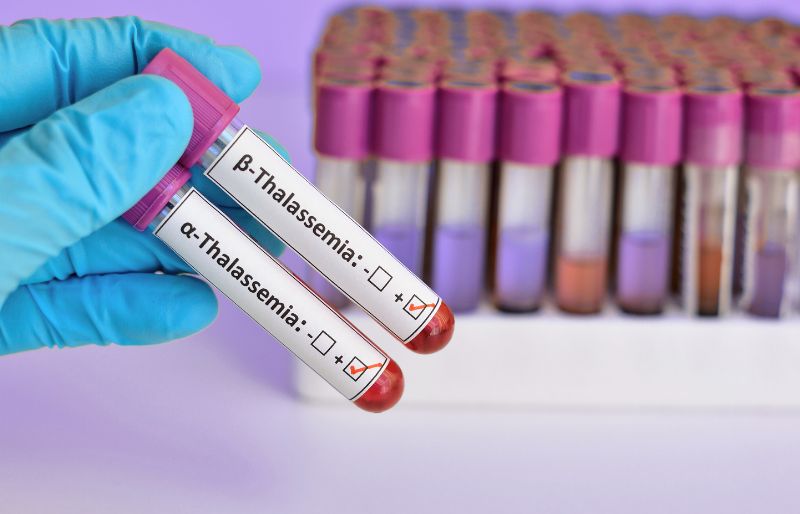 Vợ hoặc chồng mang gen di truyền Thalassemia Vợ hoặc chồng mang gen di truyền Thalassemia